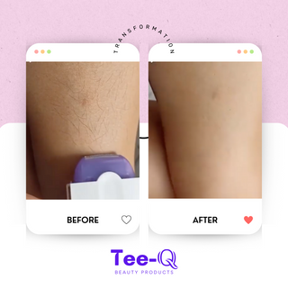 Tee-Q Shavi | Laser Hair Remover